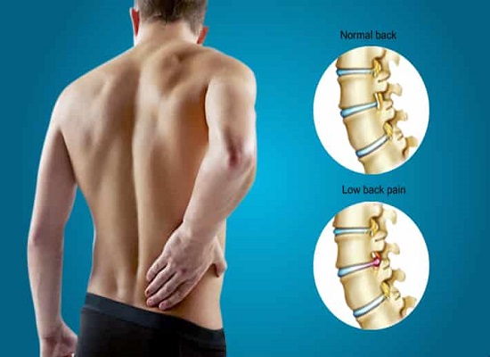 Various Overlooked Remedies for Lower Back Pain Relief