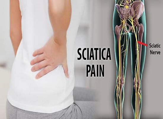 Living with Chronic Pain – What is Sciatica Pain