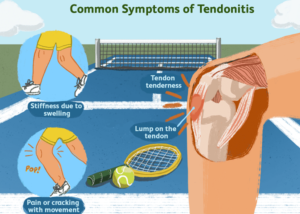 tendinosis treatments
