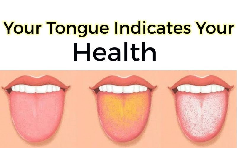The tongue is also an excellent indicator of overall health.