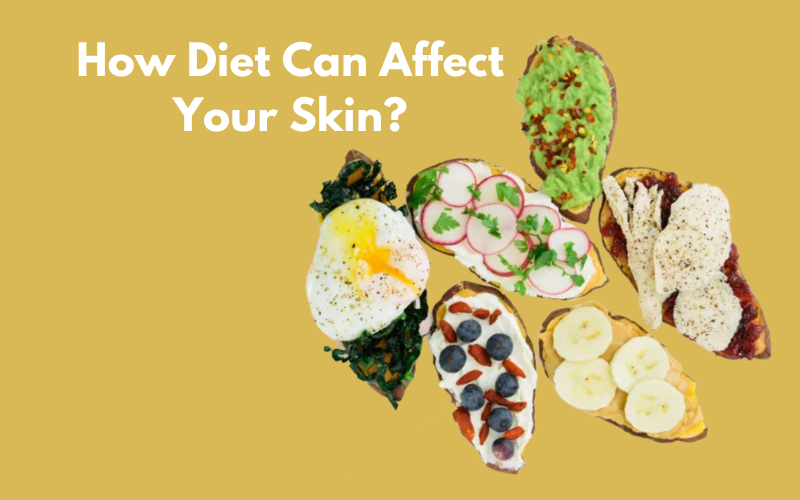 The Importance of Diet for Your Skin?