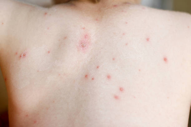 Red spots on the skin: Causes& Treatment.